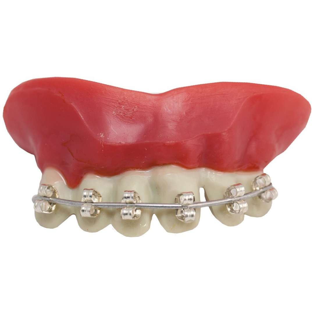 _xx_Prothesis dentures with putty